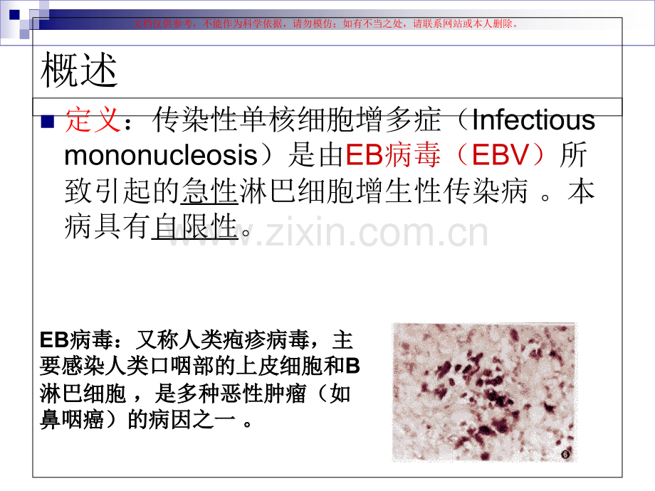 传染性单核细胞增医疗护理查房课件.ppt_第2页