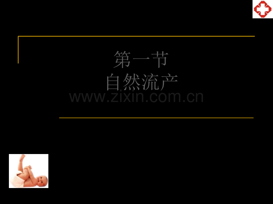 妊娠并发症妇女护理.ppt_第3页