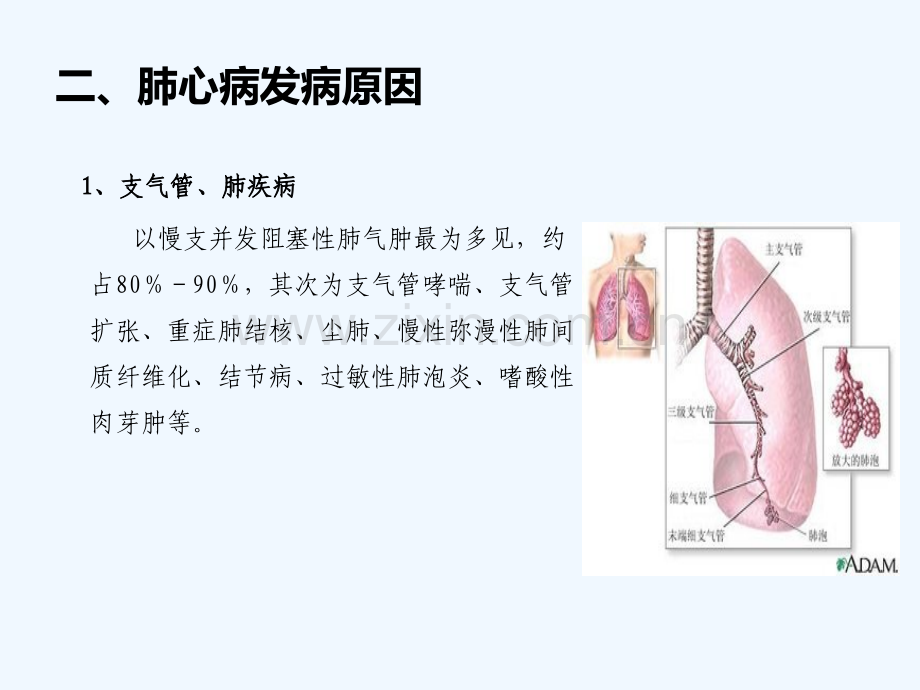 肺心病治疗和预防.pptx_第3页