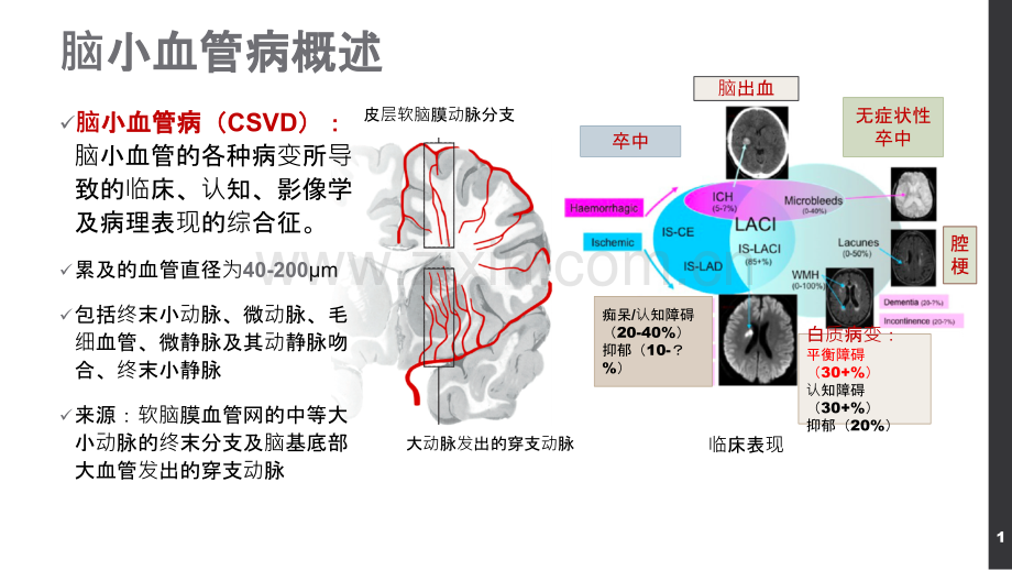 PPT医学课件脑小血管病与头晕及平衡障碍讲义.ppt_第1页