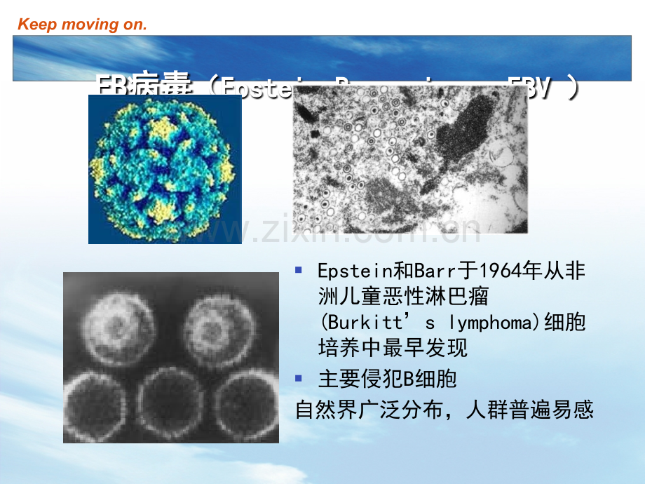 EB病毒感染和传染性单核细胞增多症PPT培训课件.ppt_第3页