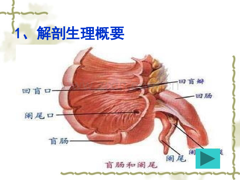 阑尾炎病人的护理-.ppt_第3页