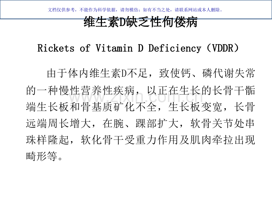 佝偻病专业医学知识宣讲课件.ppt_第3页