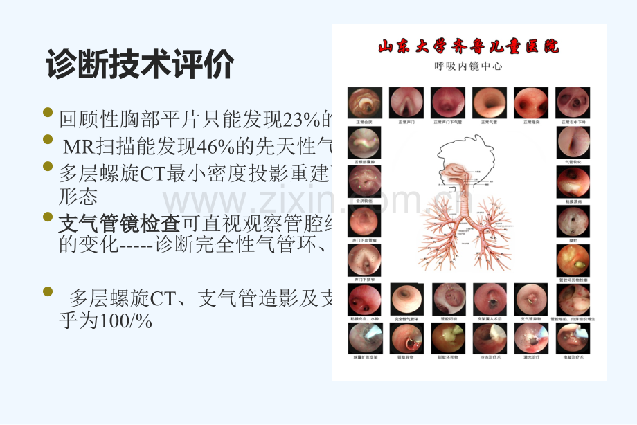 儿童先天性气道畸形马静.pptx_第3页