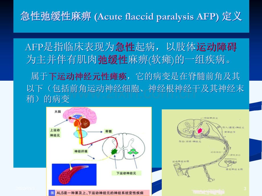 急性弛缓性麻痹-的诊断.ppt_第3页