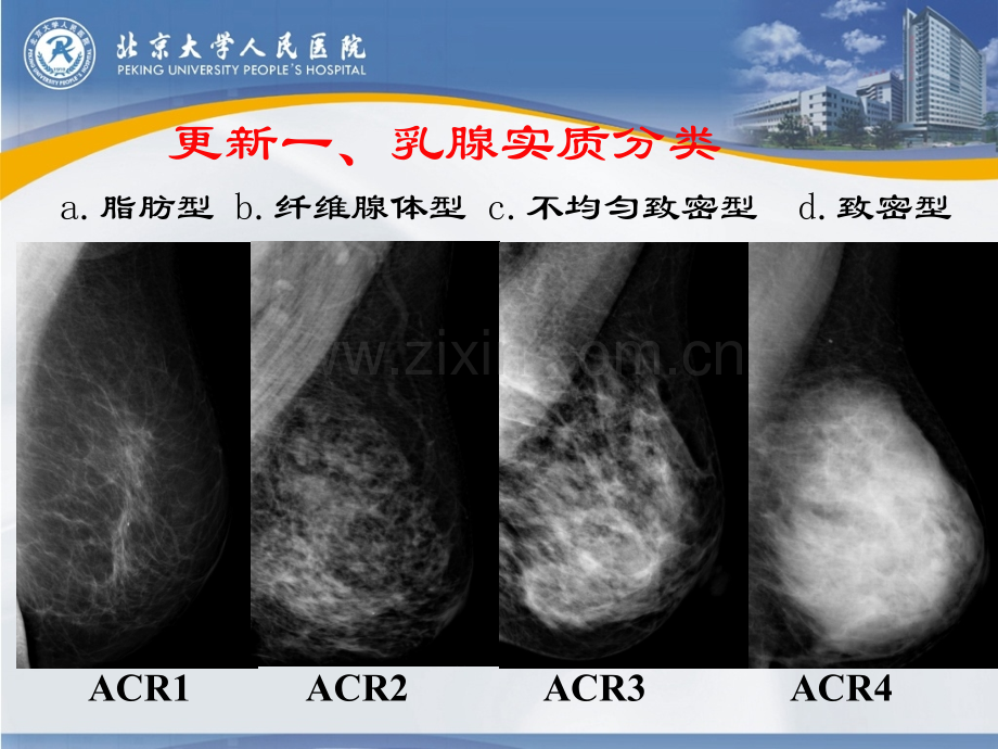 医学五BIRADS分类更新解读乳腺钼靶PPT培训课件.ppt_第3页