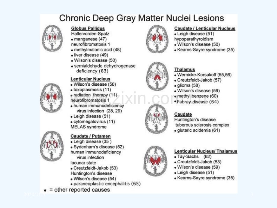 慢性深部脑白质病变的影像学鉴别诊断.ppt_第3页
