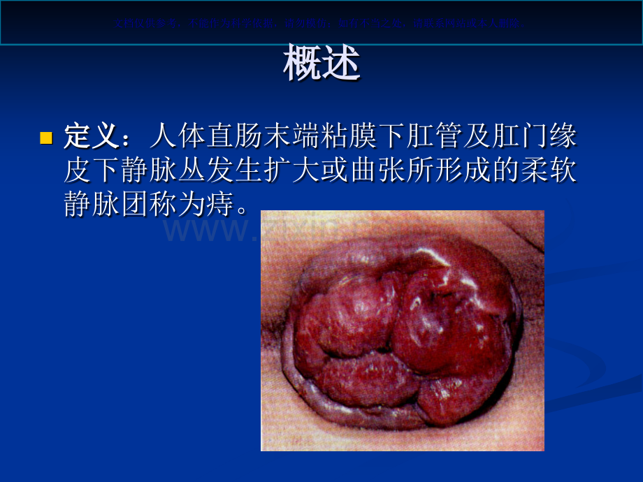 中医肛肠痔专业医学知识宣讲课件.ppt_第1页