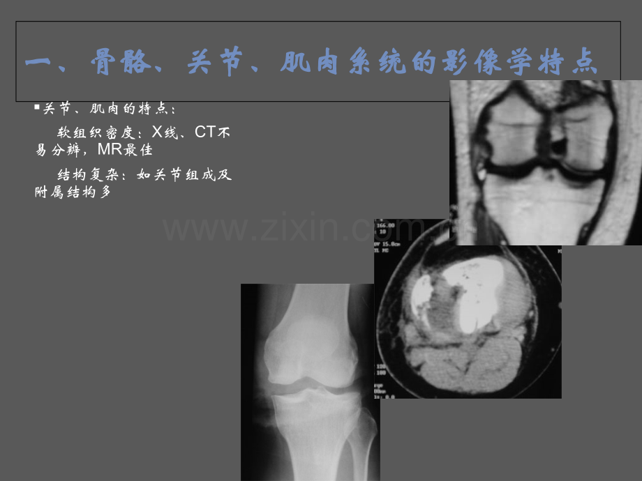 骨关节肌肉系统影像学诊断.ppt_第3页