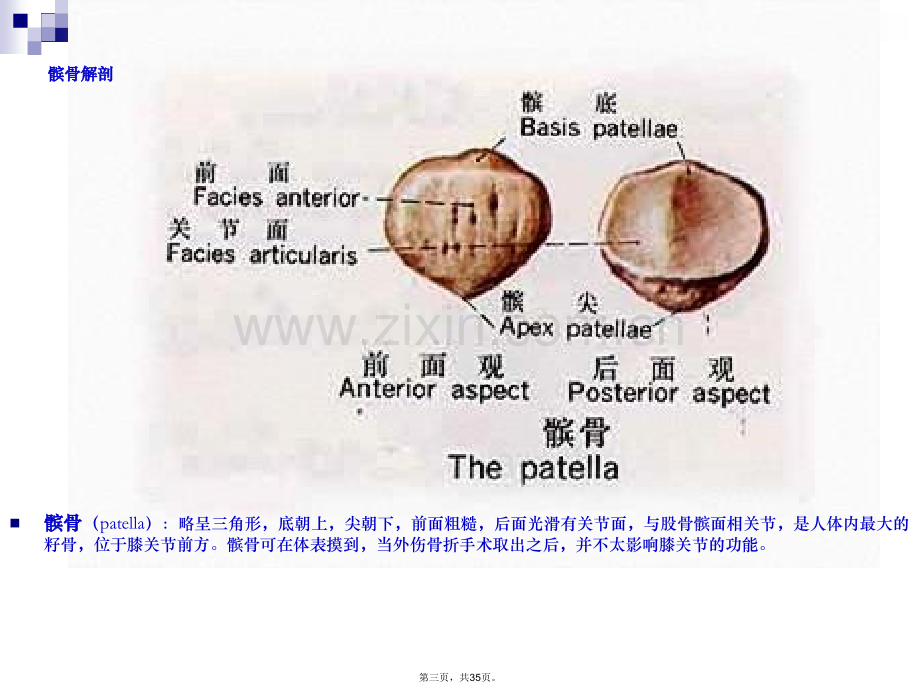 股前外侧皮瓣逆行修复同侧创面护理查房.pptx_第3页