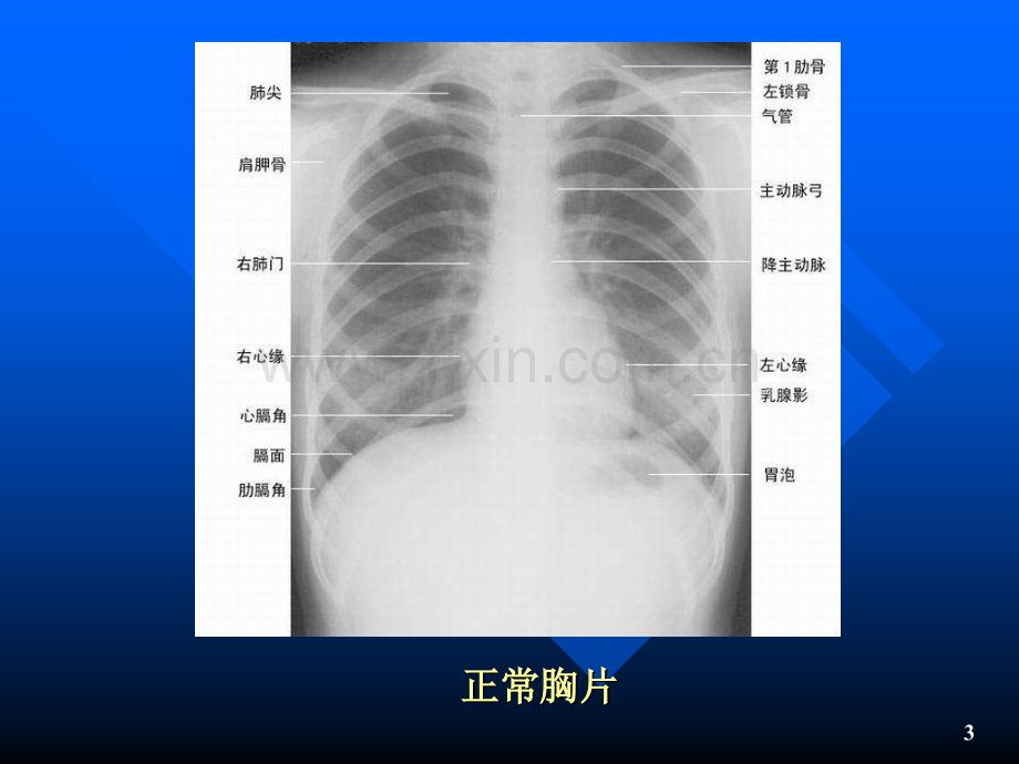 PPT医学课件血透病人的饮食与营养讲义.ppt_第3页