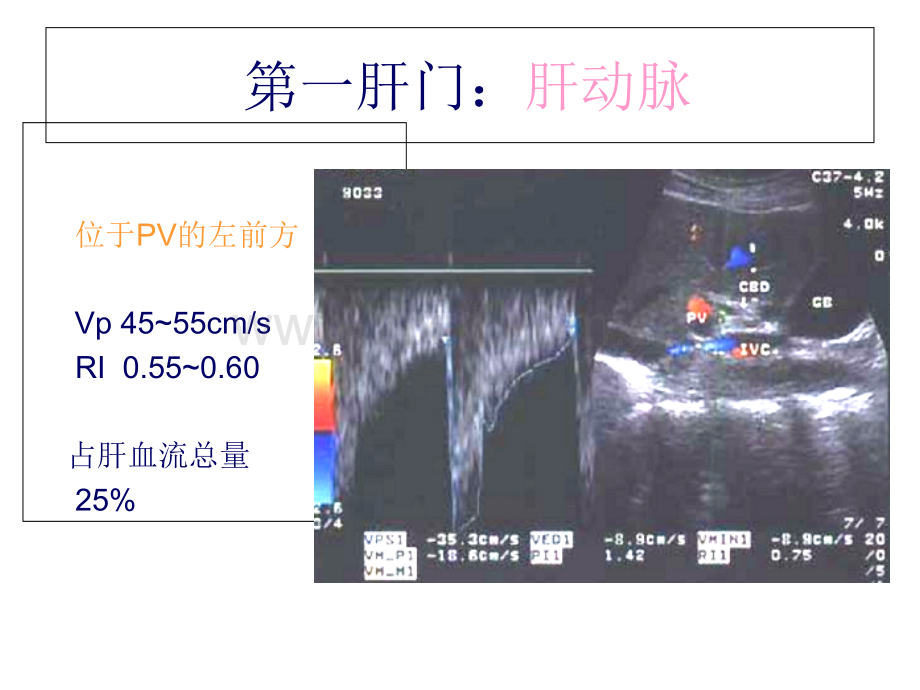 影像-B超-图谱-肝胆超声诊断学.ppt_第2页