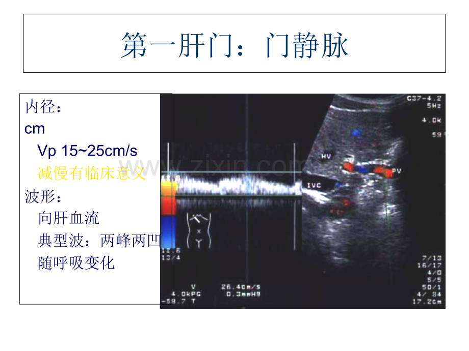 影像-B超-图谱-肝胆超声诊断学.ppt_第3页