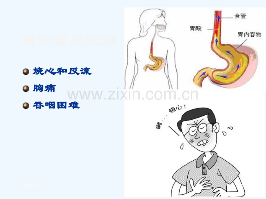 胃炎课件精华版.ppt_第3页