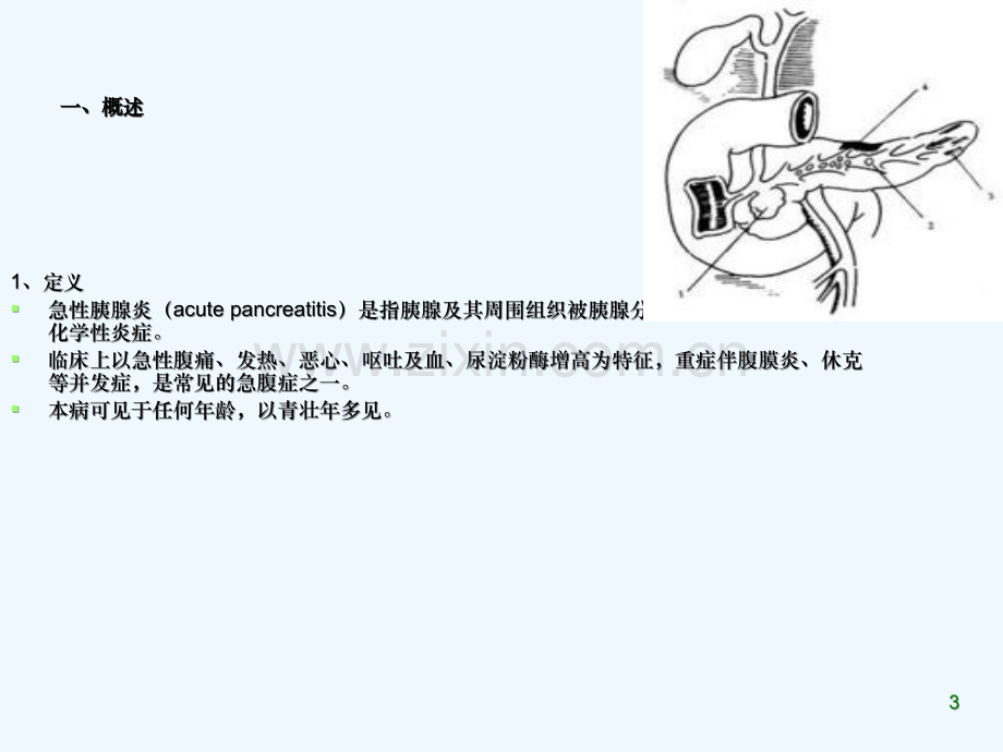 医学资料急性胰腺炎病人护理.ppt_第3页