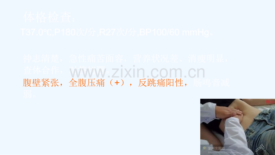 急性腹膜炎并发感染性休克.ppt_第3页