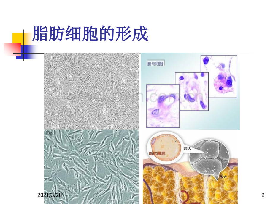 有关脂肪栓塞综合征课件.ppt_第2页