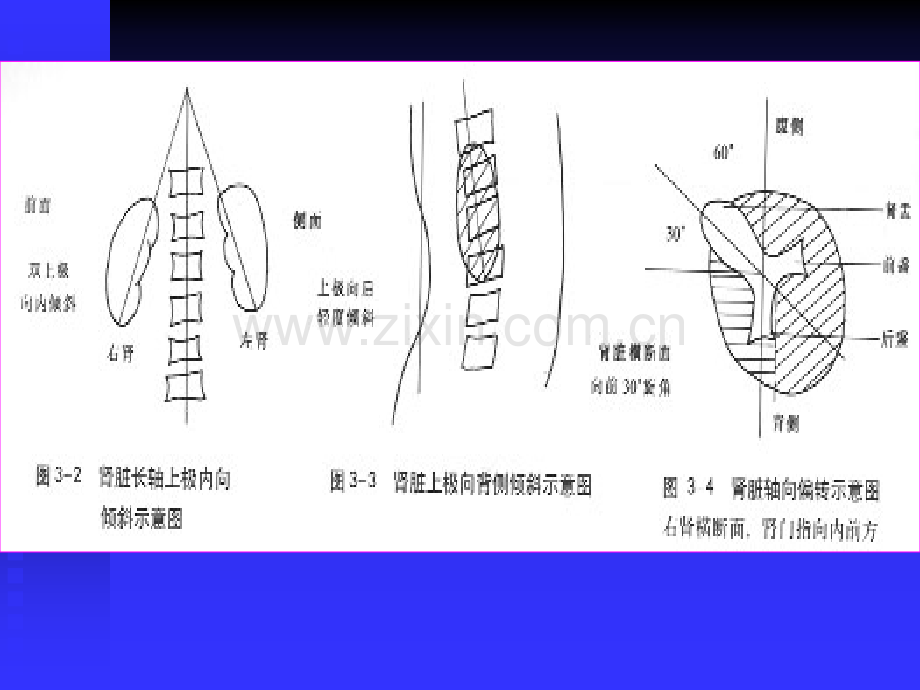 PPT医学课件肾脏标准切面讲义.ppt_第2页