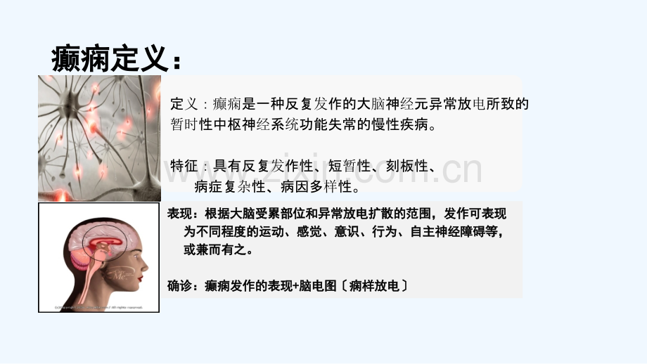 癫痫的诊断与治疗.ppt_第3页