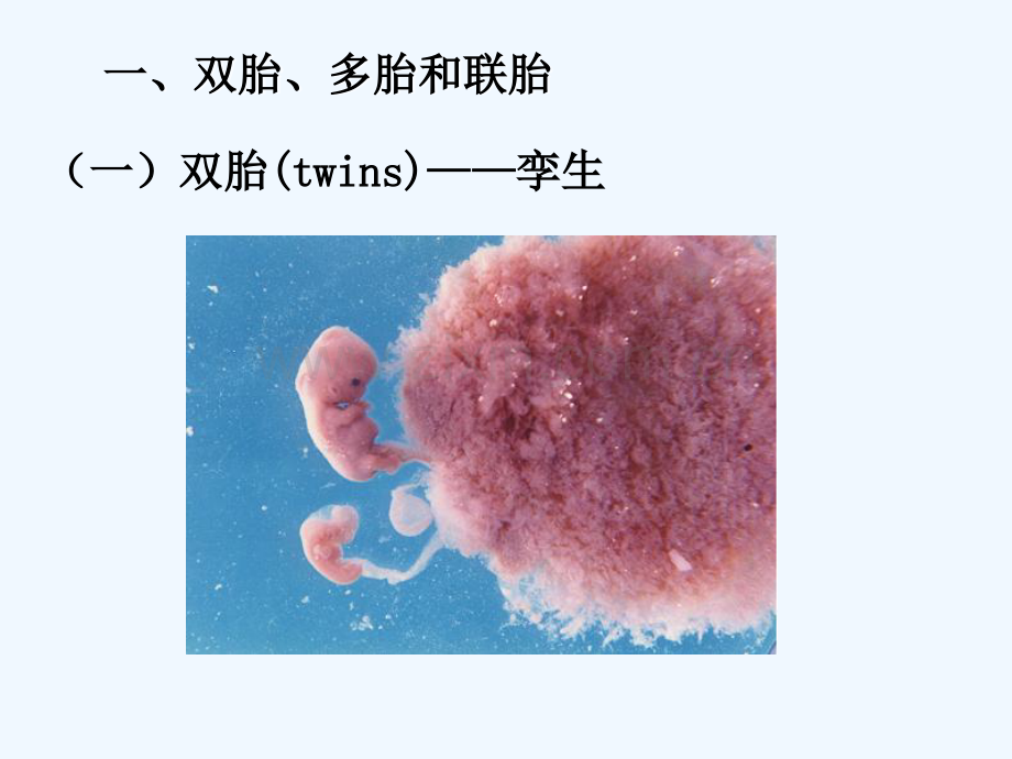 双胎、畸形颜面、消化、呼吸系统发生.pptx_第2页