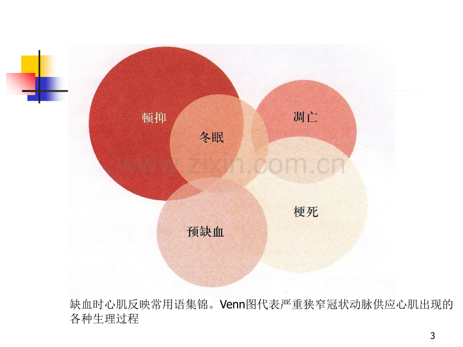 心肌顿抑与冬眠心肌-教学课件.ppt_第3页