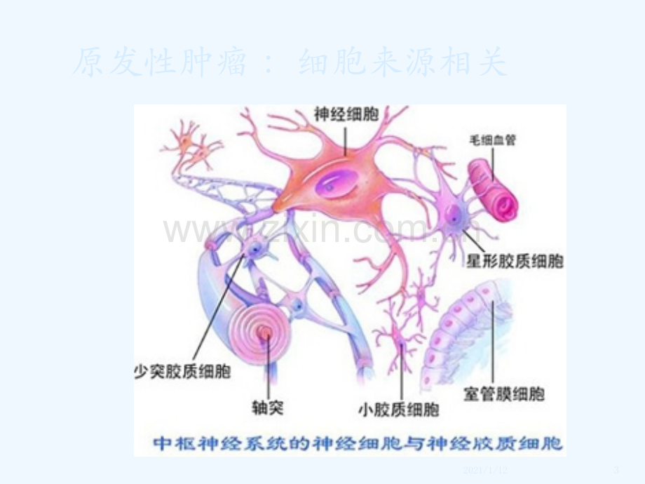 影像诊断中枢神经系统肿瘤.ppt_第3页