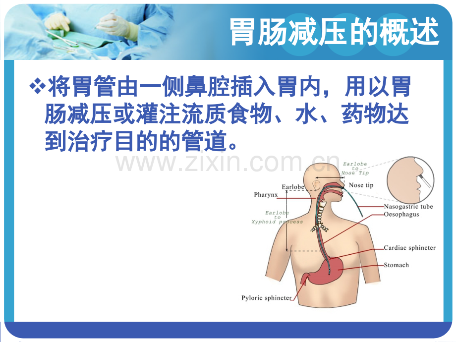 PPT医学课件胃肠减压的护理讲义.ppt_第3页