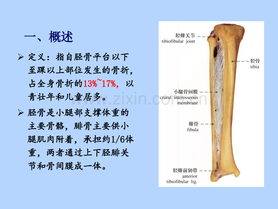 PPT医学课件胫腓骨骨折患者的个案护理讲义.ppt_第2页