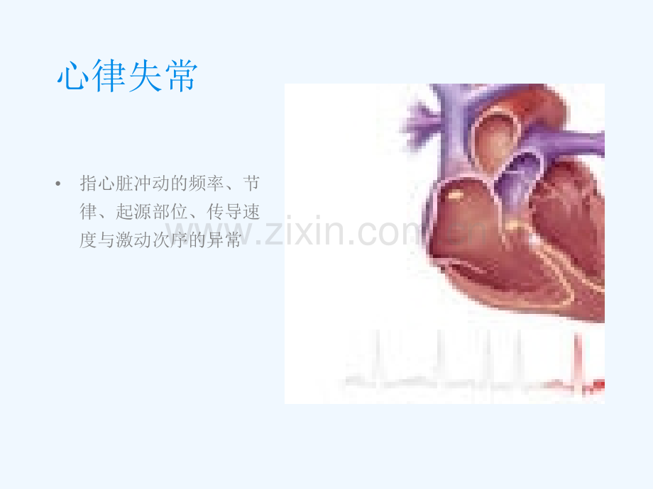 内科护理学循环系统心律失常.ppt_第3页