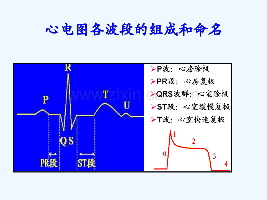 临床常见心律失常的识别及治疗.ppt_第3页