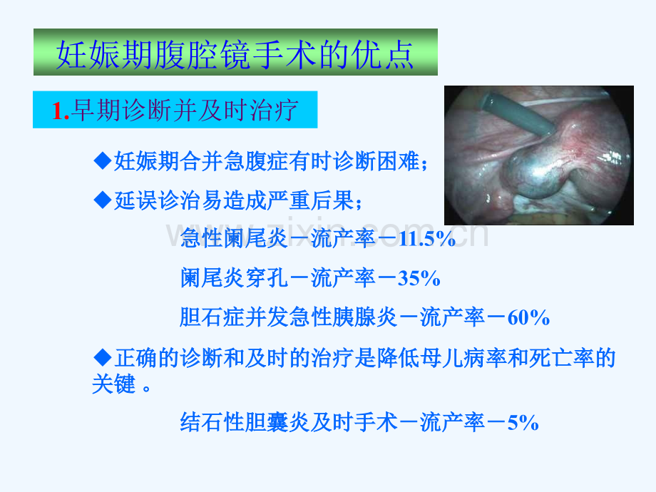 妊娠期腹腔镜手术.pptx_第2页