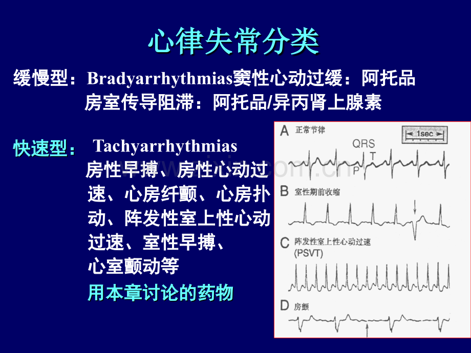 常用抗心律失常药及用药护理.ppt_第3页