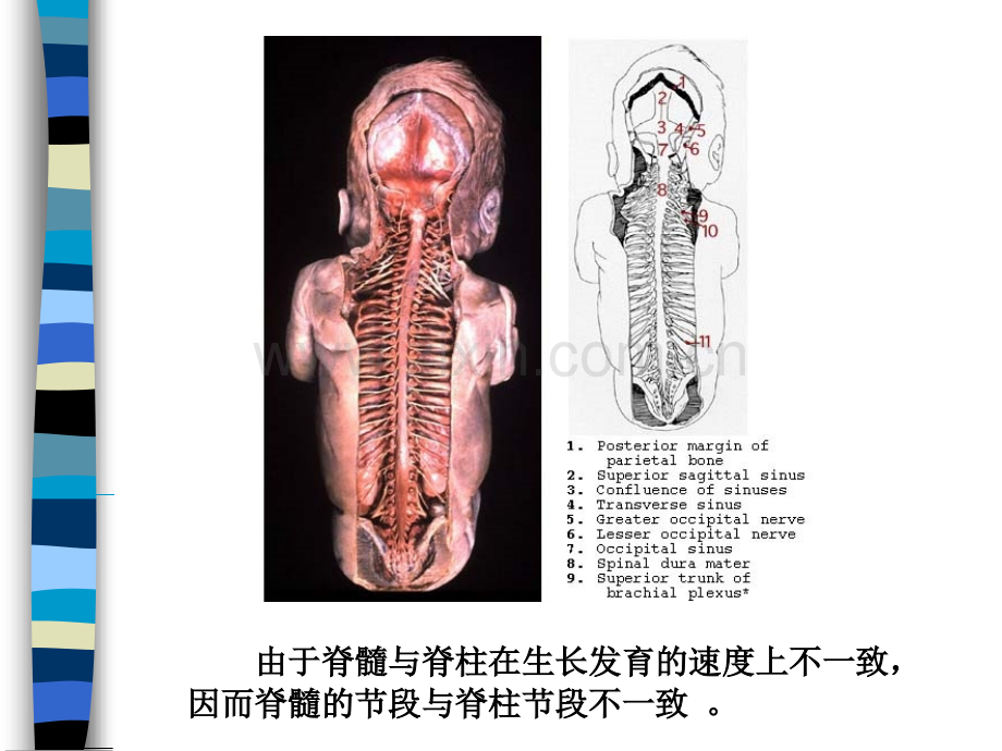 PPT医学课件脊髓病基础知识讲义.ppt_第2页