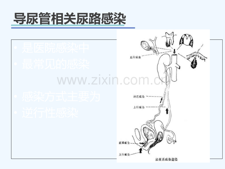 导尿管相关感染护理控制.ppt_第3页