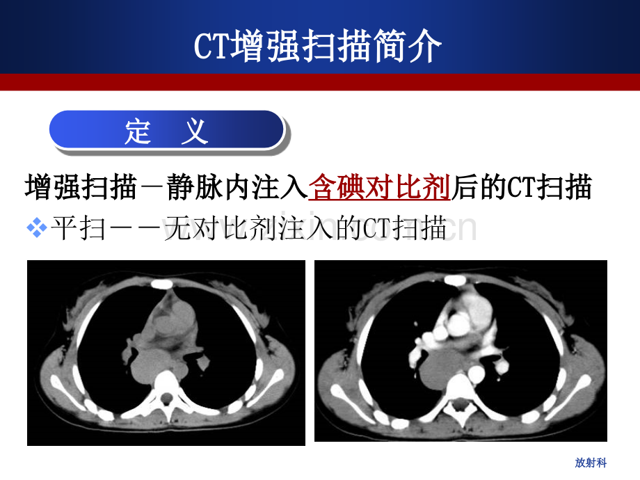 CT增强扫描的临床应用医学知识讲解讲义.ppt_第3页