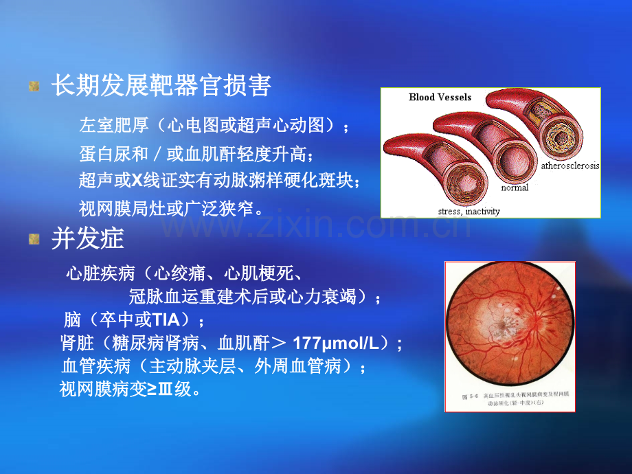 抗高血压药物的器官保护作用.ppt_第3页