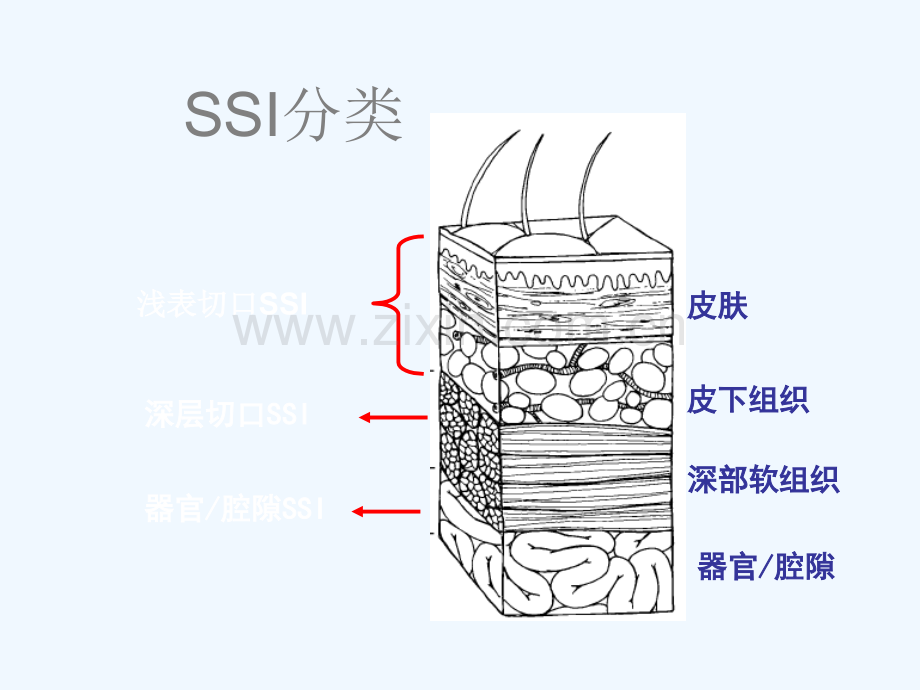 手术部位感染的控.ppt_第3页