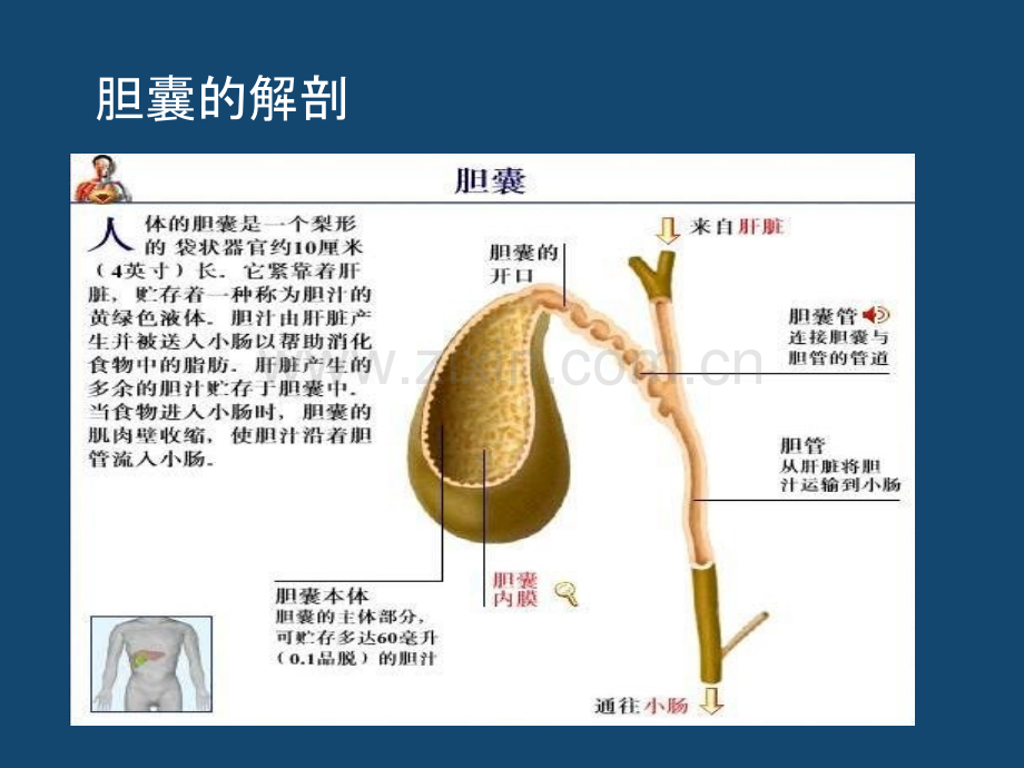 内科学急性胆囊炎PPT培训课件.ppt_第3页