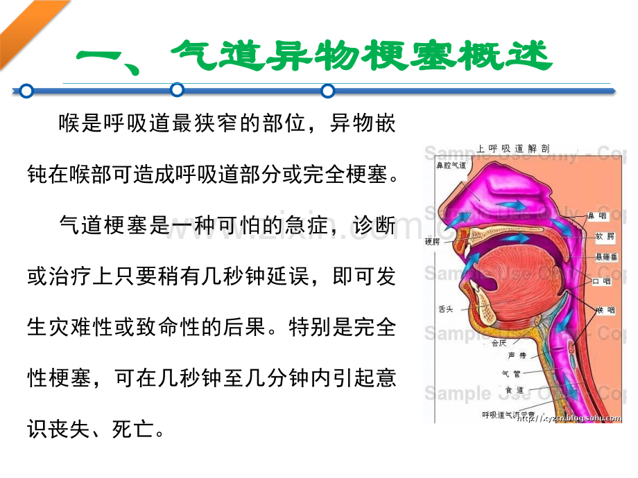 气道异物梗阻急救培训讲义.ppt_第3页