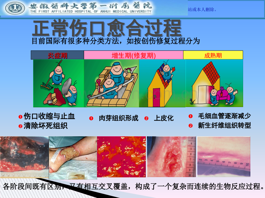 伤口湿性愈合理论和应用课件.ppt_第3页