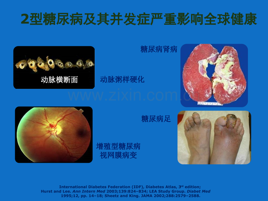 PPT医学课件胰岛素分类及特点讲义.ppt_第2页