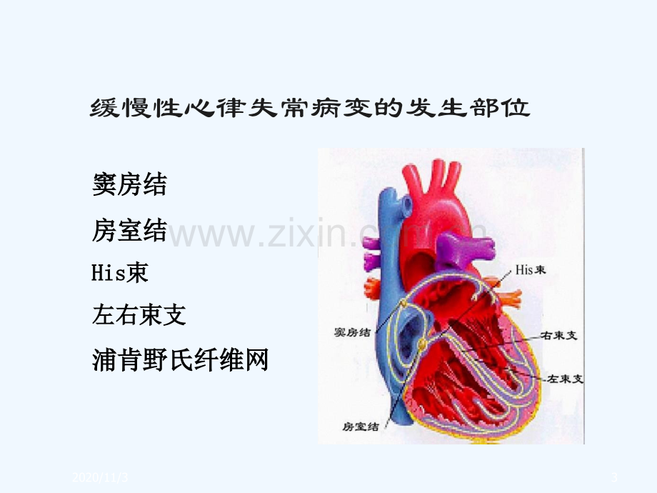 缓慢性心律失常的诊断和治疗.ppt_第3页