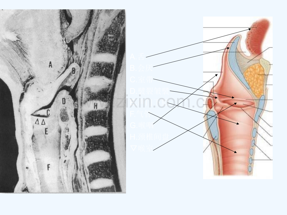 喉的CT解剖.ppt_第2页