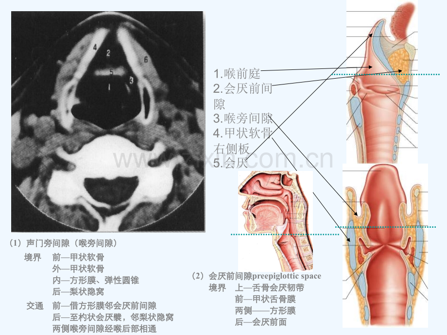 喉的CT解剖.ppt_第3页