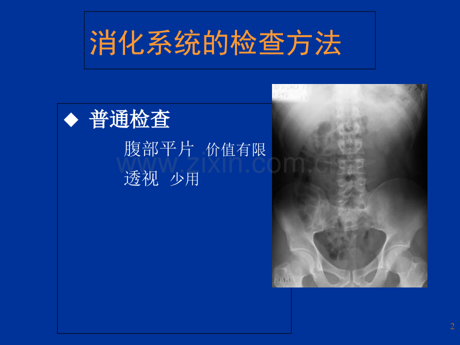 消化系统影像诊断工程课件.ppt_第2页