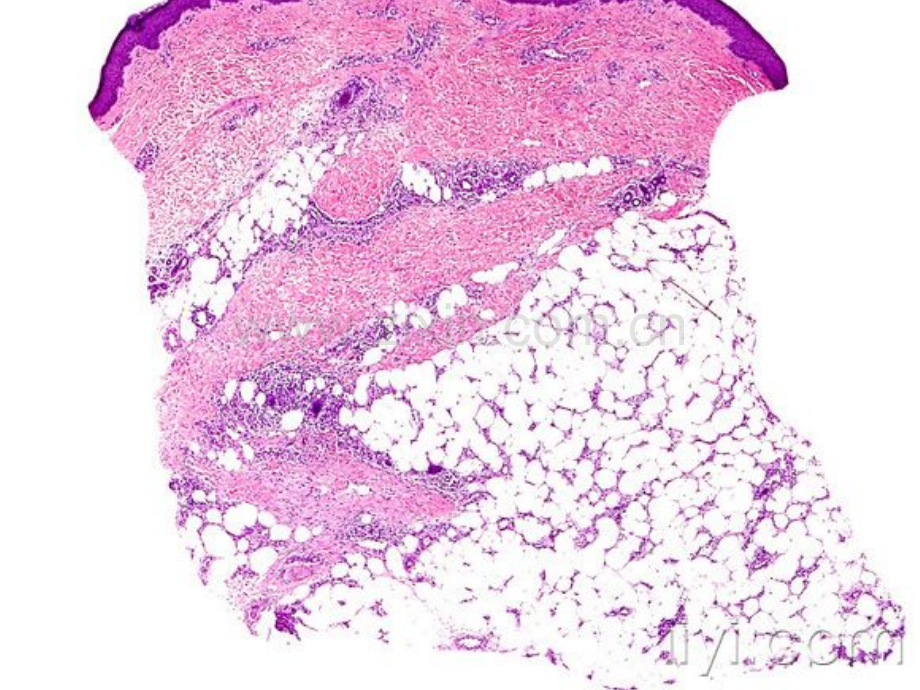 皮肤病理与临床典型病例.pptx_第3页