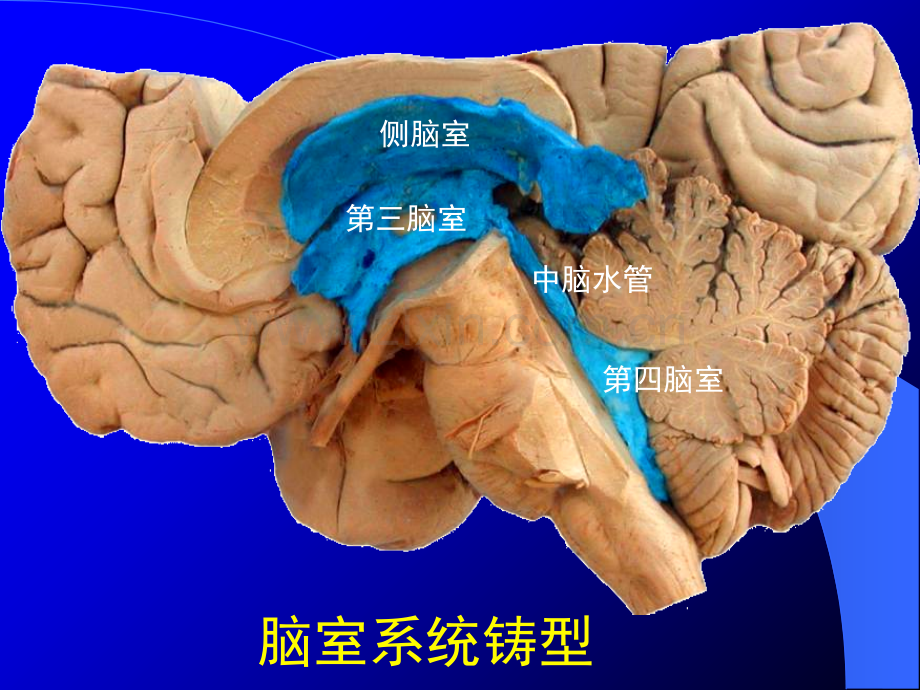 PPT医学课件脑室的断层解剖讲义.ppt_第2页