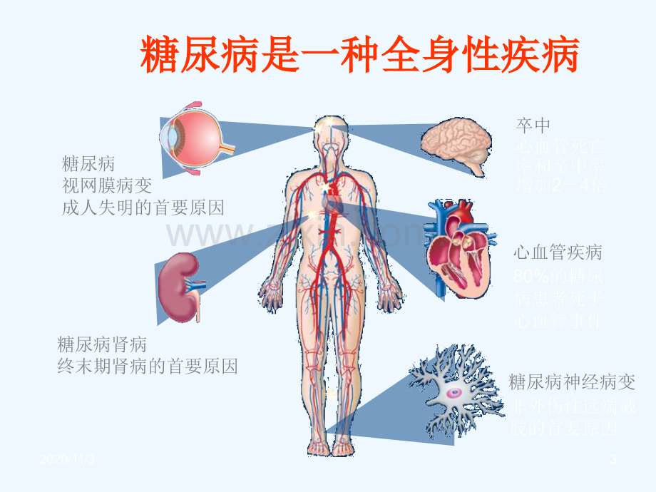 糖尿病患者的饮食治疗.ppt_第3页