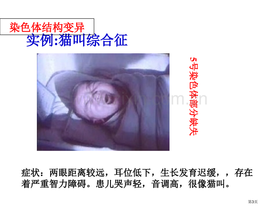 高二生物染色体变异省公共课一等奖全国赛课获奖课件.pptx_第3页