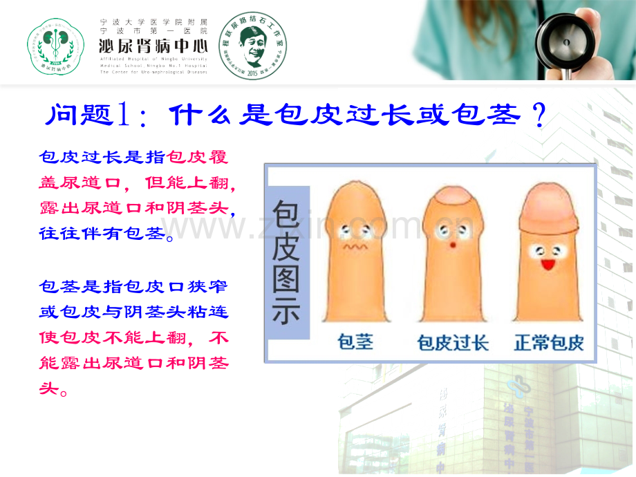 包皮过包皮的常见问题医学PPT课件.ppt_第2页